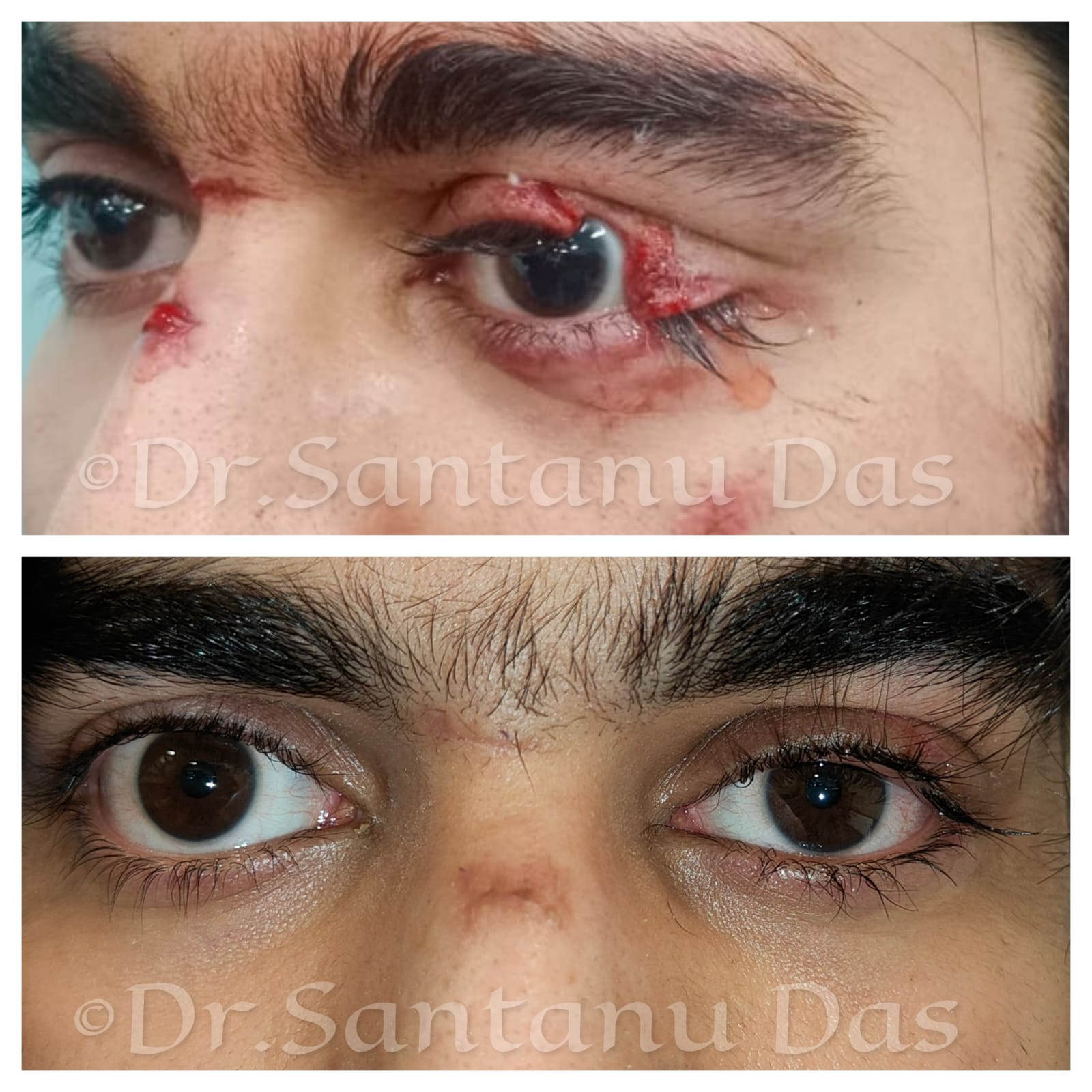 Trauma Management